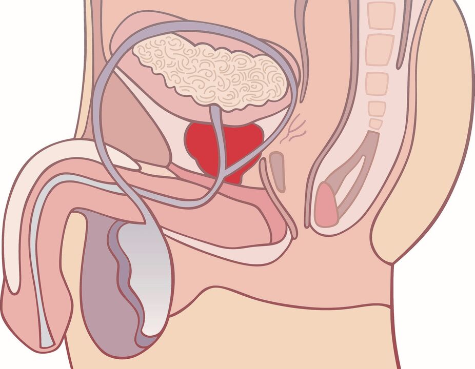 stan zapalny prostaty z zapaleniem gruczołu krokowego